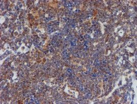 ATRIP Antibody in Immunohistochemistry (Paraffin) (IHC (P))