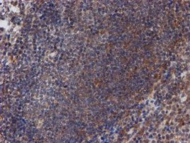 ATRIP Antibody in Immunohistochemistry (Paraffin) (IHC (P))