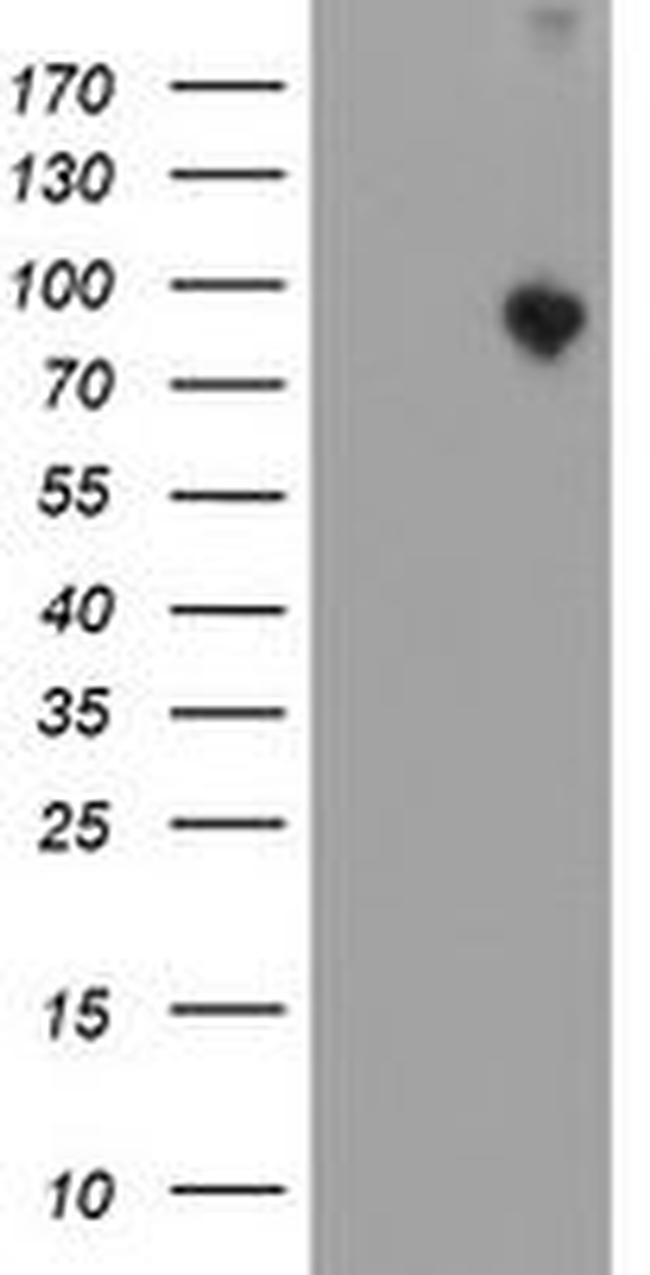 ATRIP Antibody in Western Blot (WB)