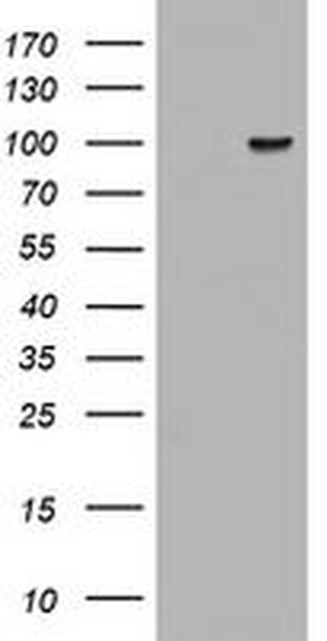 ATRIP Antibody in Western Blot (WB)