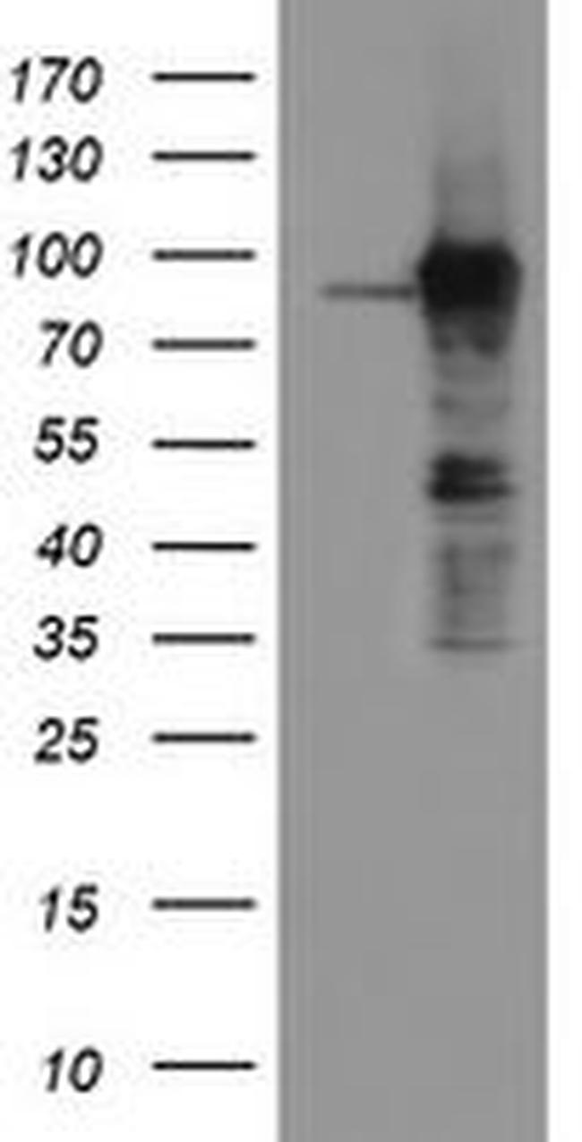 ATRIP Antibody in Western Blot (WB)