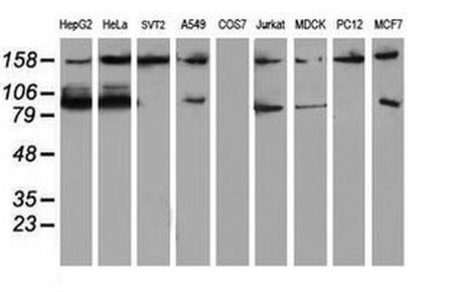 ATRIP Antibody in Western Blot (WB)