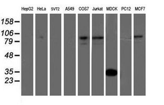 ATRIP Antibody in Western Blot (WB)