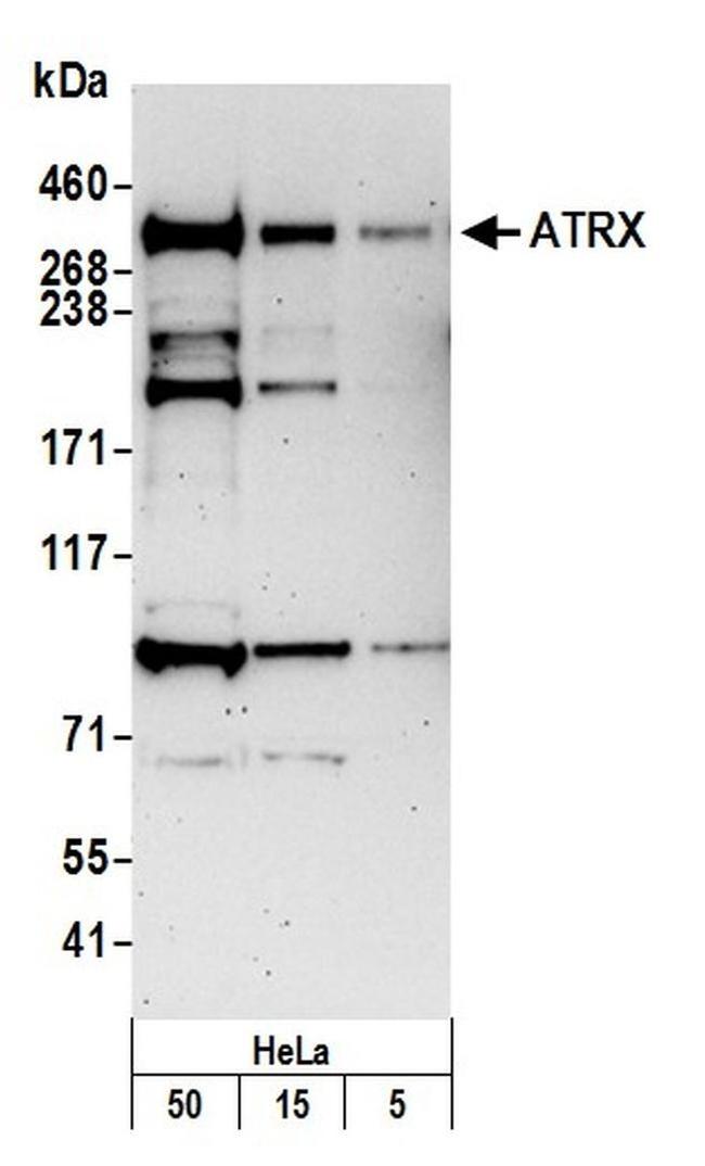 ATRX Antibody in Western Blot (WB)