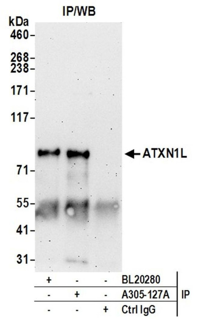 ATXN1L Antibody in Immunoprecipitation (IP)
