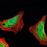 Ataxin 1 Antibody in Immunocytochemistry (ICC/IF)