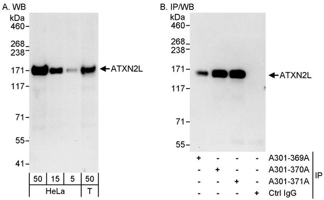 ATXN2L Antibody in Western Blot (WB)