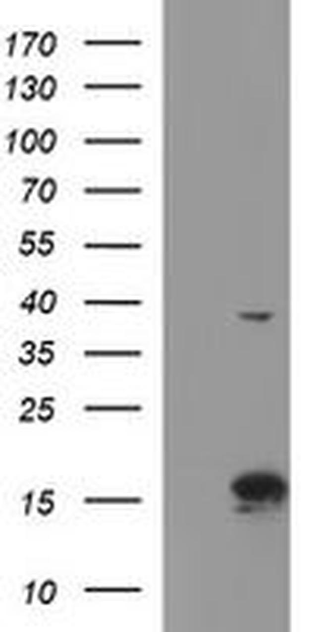 ATXN7L1 Antibody in Western Blot (WB)