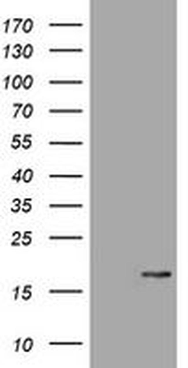 ATXN7L1 Antibody in Western Blot (WB)