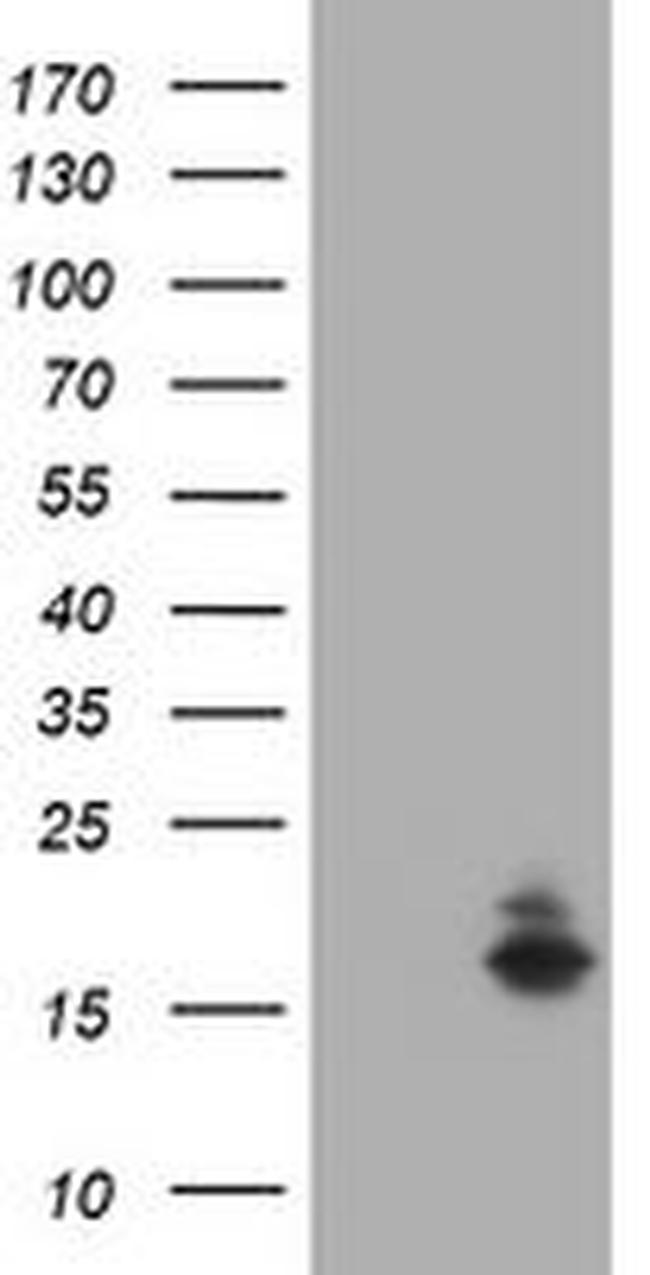 ATXN7L1 Antibody in Western Blot (WB)