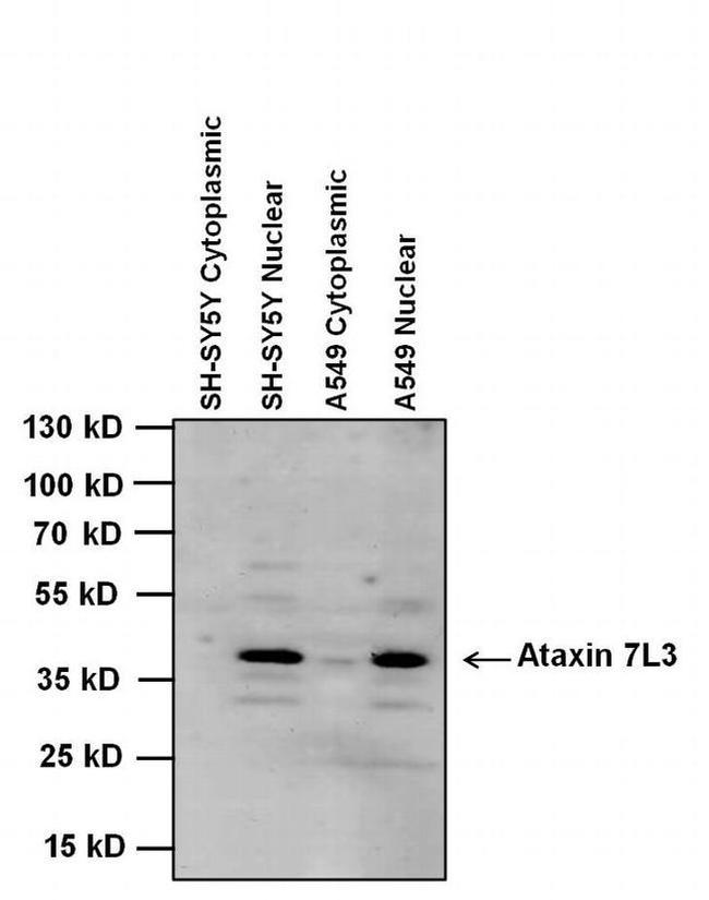 ATXN7L3 Antibody in Western Blot (WB)