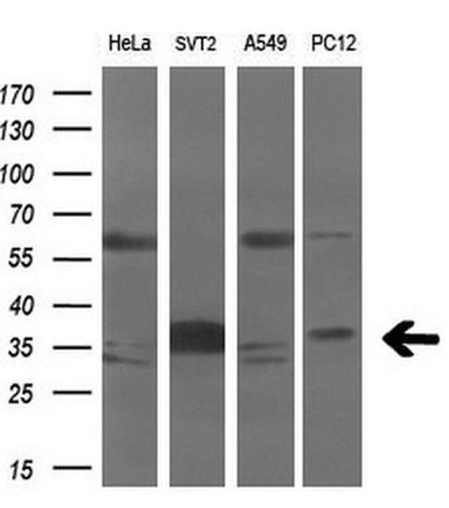 AURKC Antibody in Western Blot (WB)