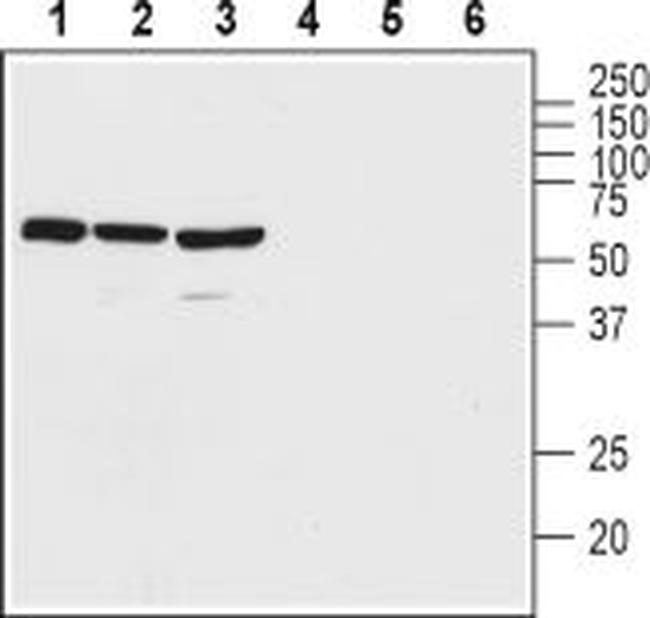 VPAC2 (VIPR2) (extracellular) Antibody in Western Blot (WB)