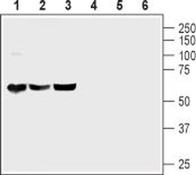 PACAP Receptor 1 (PAC1) Antibody in Western Blot (WB)
