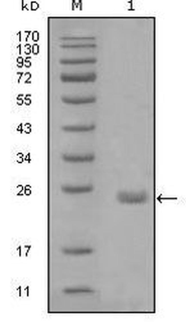 Axl Antibody in Western Blot (WB)