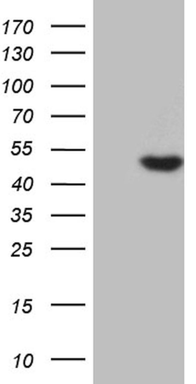 AZIN1 Antibody in Western Blot (WB)