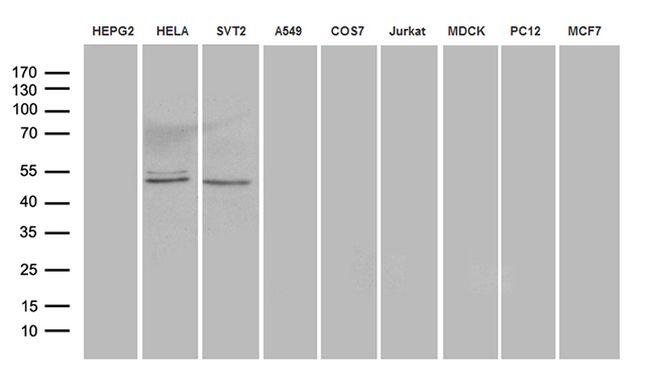 AZIN1 Antibody in Western Blot (WB)