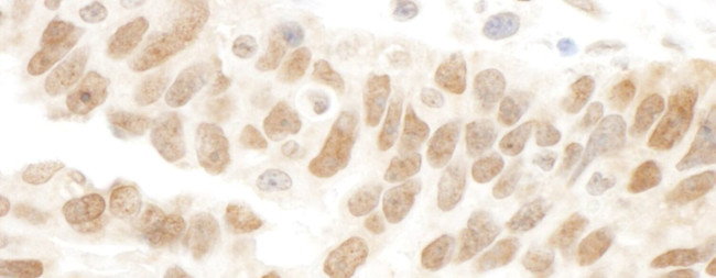 Abraxas Antibody in Immunohistochemistry (IHC)