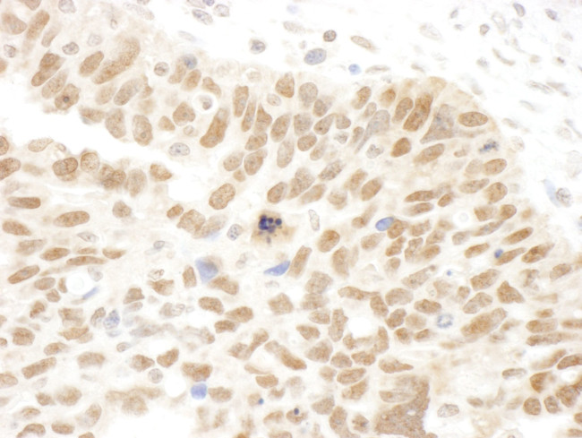 Abraxas Antibody in Immunohistochemistry (IHC)