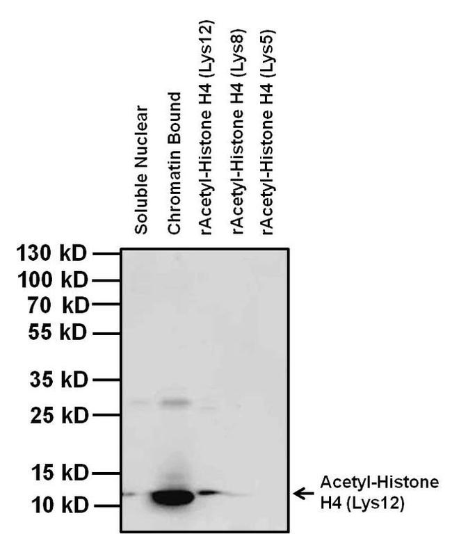 H4K12ac Antibody in Western Blot (WB)