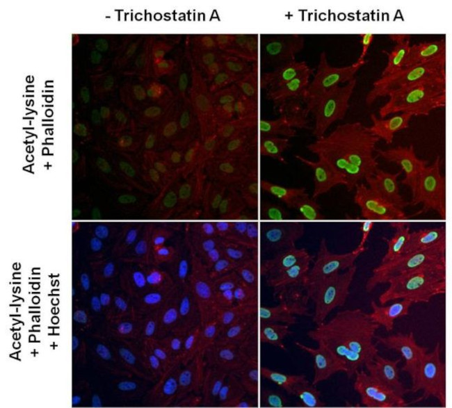 Acetylated Lysine Antibody in Immunocytochemistry (ICC/IF)