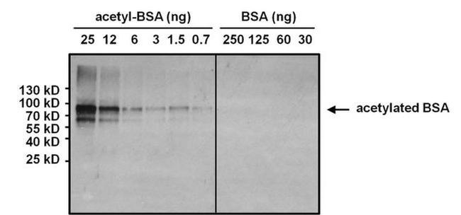 Acetylated Lysine Antibody in Western Blot (WB)