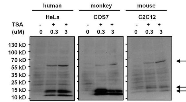 Acetylated Lysine Antibody in Western Blot (WB)