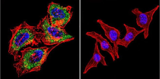 Acetylcholinesterase Antibody in Immunocytochemistry (ICC/IF)