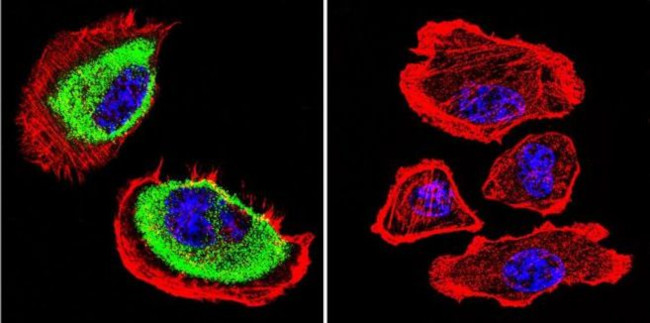 Acetylcholinesterase Antibody in Immunocytochemistry (ICC/IF)