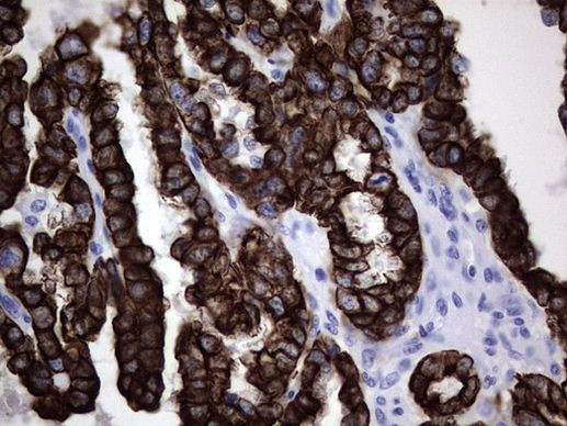 Acidic Cytokeratin Antibody in Immunohistochemistry (Paraffin) (IHC (P))