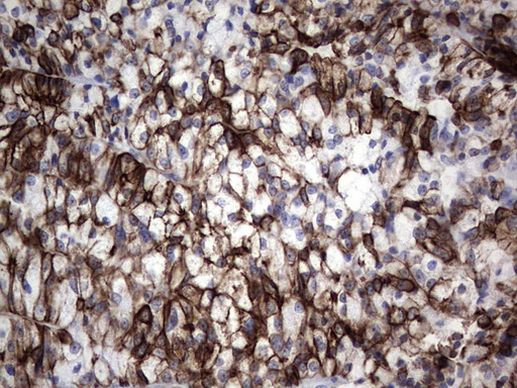 Acidic Cytokeratin Antibody in Immunohistochemistry (Paraffin) (IHC (P))