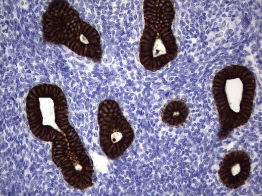 Acidic Cytokeratin Antibody in Immunohistochemistry (Paraffin) (IHC (P))