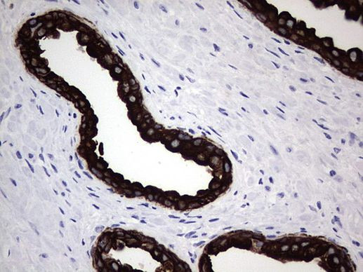 Acidic Cytokeratin Antibody in Immunohistochemistry (Paraffin) (IHC (P))