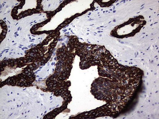 Acidic Cytokeratin Antibody in Immunohistochemistry (Paraffin) (IHC (P))