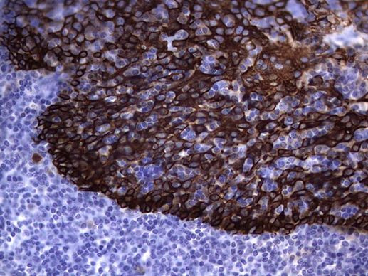 Acidic Cytokeratin Antibody in Immunohistochemistry (Paraffin) (IHC (P))