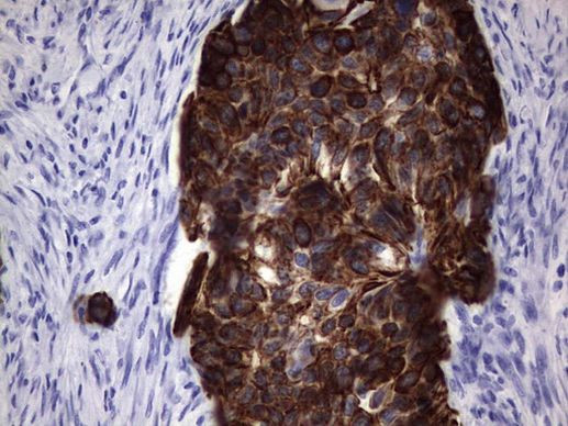 Acidic Cytokeratin Antibody in Immunohistochemistry (Paraffin) (IHC (P))