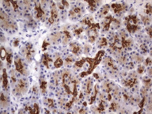 Acidic Cytokeratin Antibody in Immunohistochemistry (Paraffin) (IHC (P))