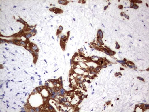 Acidic Cytokeratin Antibody in Immunohistochemistry (Paraffin) (IHC (P))