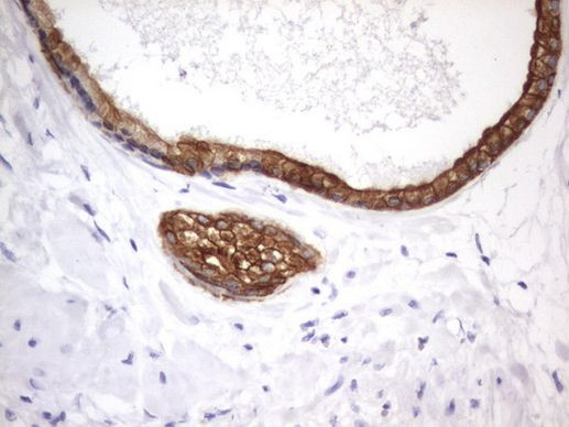 Acidic Cytokeratin Antibody in Immunohistochemistry (Paraffin) (IHC (P))