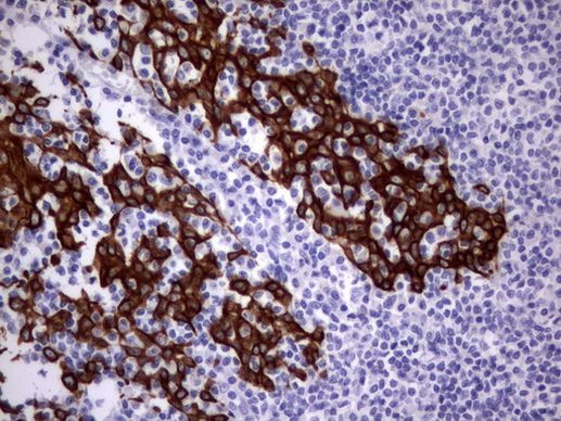 Acidic Cytokeratin Antibody in Immunohistochemistry (Paraffin) (IHC (P))