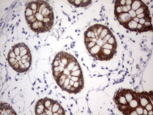 Acidic Cytokeratin Antibody in Immunohistochemistry (Paraffin) (IHC (P))