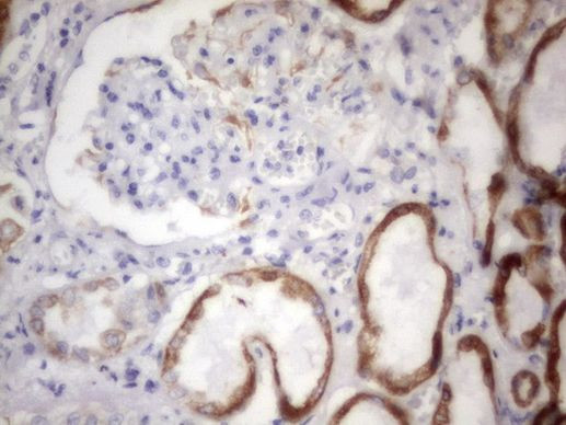 Acidic Cytokeratin Antibody in Immunohistochemistry (Paraffin) (IHC (P))