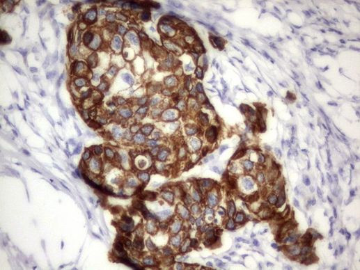 Acidic Cytokeratin Antibody in Immunohistochemistry (Paraffin) (IHC (P))