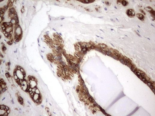 Acidic Cytokeratin Antibody in Immunohistochemistry (Paraffin) (IHC (P))