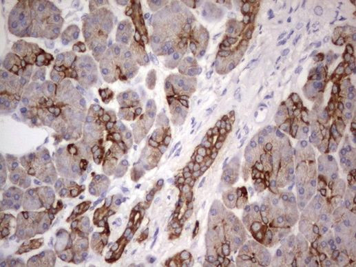 Acidic Cytokeratin Antibody in Immunohistochemistry (Paraffin) (IHC (P))