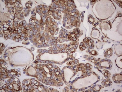 Acidic Cytokeratin Antibody in Immunohistochemistry (Paraffin) (IHC (P))