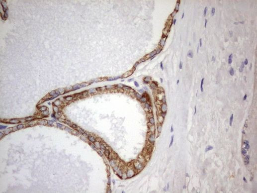 Acidic Cytokeratin Antibody in Immunohistochemistry (Paraffin) (IHC (P))