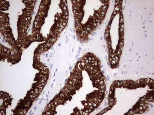 Acidic Cytokeratin Antibody in Immunohistochemistry (Paraffin) (IHC (P))