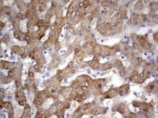 Acidic Cytokeratin Antibody in Immunohistochemistry (Paraffin) (IHC (P))