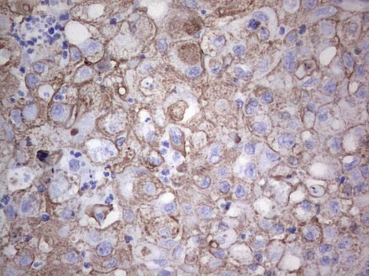 Acidic Cytokeratin Antibody in Immunohistochemistry (Paraffin) (IHC (P))